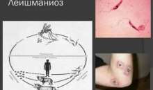 Лейшманиоз: симптомы и меры профилактики